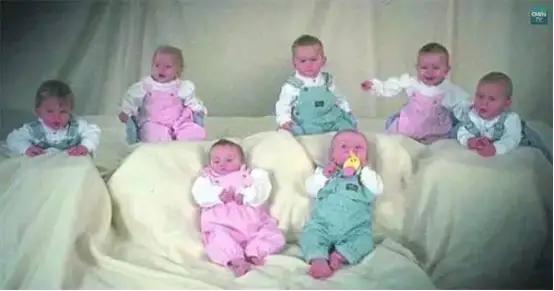 世界上首例存活的七胞胎已长大成人，组图看完成长过程，实属不易