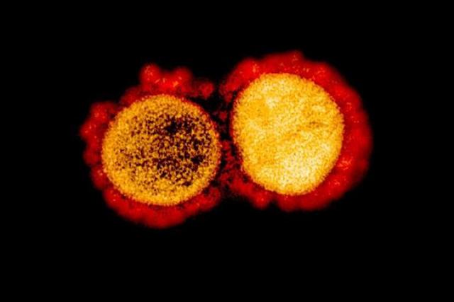 印尼发现新冠病毒变异，传染性或比原始病株高十倍