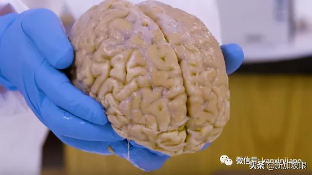 捐脑袋？新加坡脑库迎来首次两颗自发捐赠的大脑