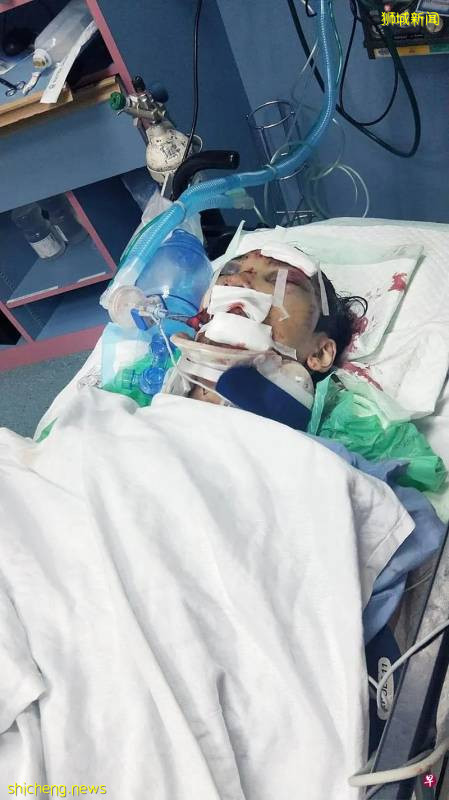 机车失控人抛飞掉沟渠 送餐员头骨裂昏迷