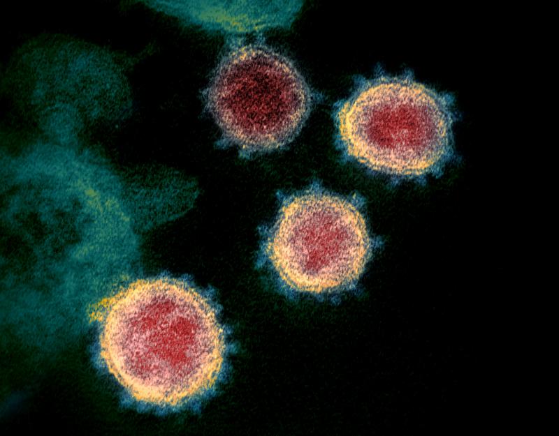 20200320-coronavirus.jpg