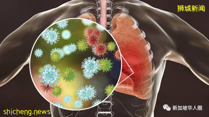 新增34例！​​新加坡有症状者检测仅0.03%确诊！社区感染低基本受控