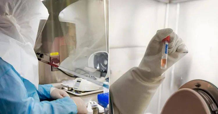 新加坡看病血泪史！新冠看病最贵花光存款，最新版住院手术费用汇总