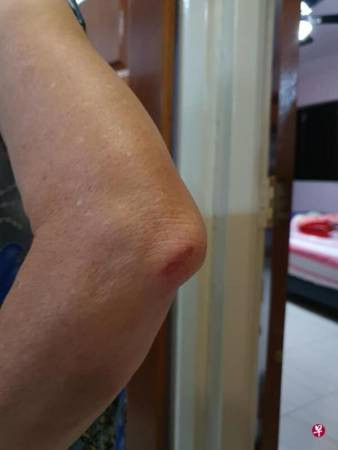 上巴士未坐稳 车长即开车 阿嫲失衡跌伤