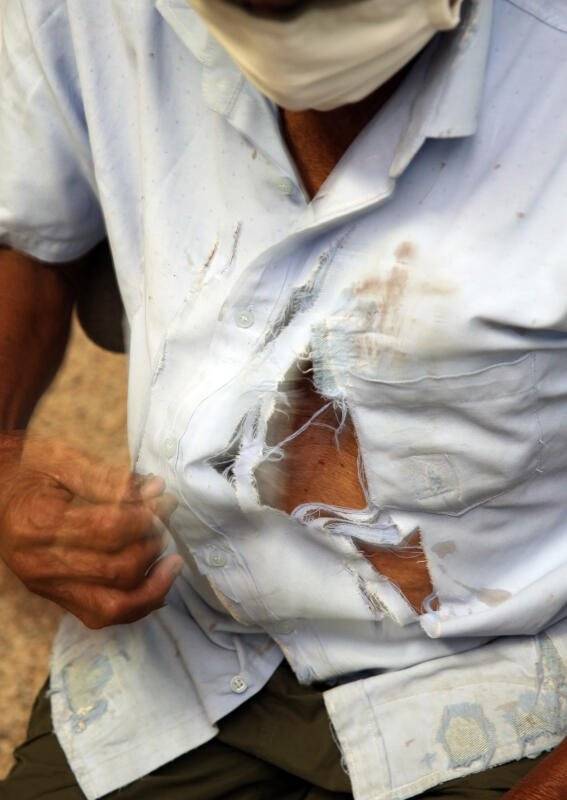 阿伯打喷嚏除口罩 遭人泼水攻击