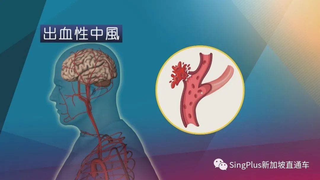 新加坡社区开始接种新冠疫苗！全球数十人接种辉瑞疫苗后死亡