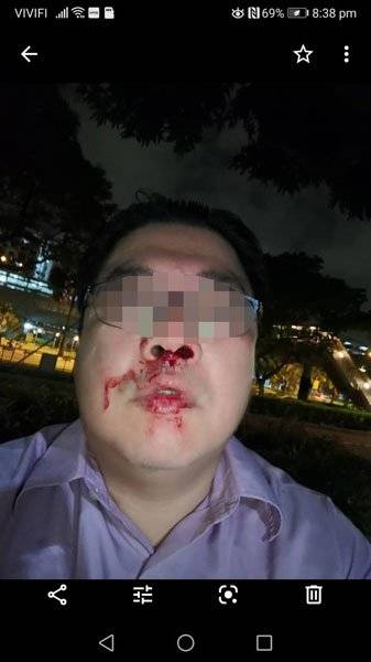 “这不是你爷爷的路！” 人行道路霸 打到人骨折