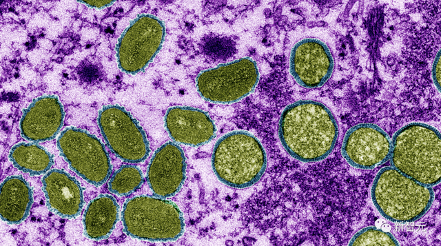 新冠之後WHO宣布最高級別警告！全球超1.6萬猴痘感染者，遍及75國