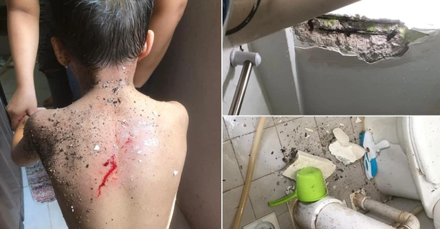豆腐渣！新加坡男孩住公租房洗澡，天花板突然塌了，後背砸出血