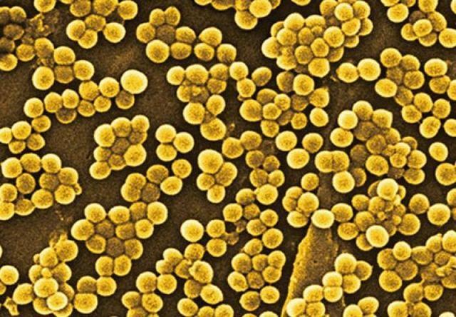 荷蘭曝兩起奶粉汙染，新加坡多美滋奶粉檢出阪崎腸杆菌