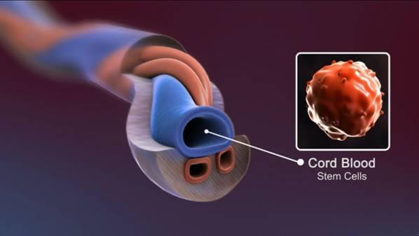 平均1.2年一个医学奇迹 脐带血临床应用简史