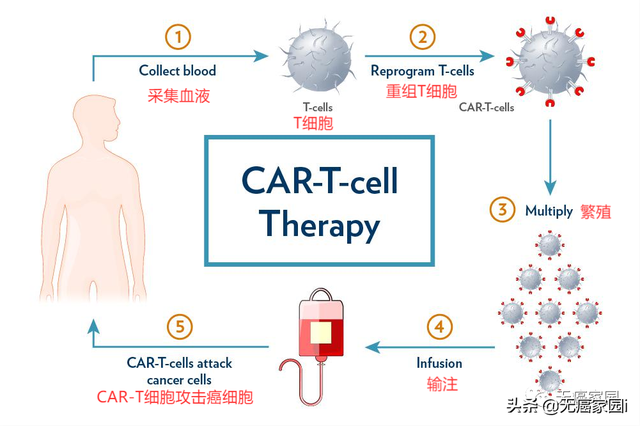 抗癌終極殺招！得益于新型CAR-T細胞療法，晚期癌症患者獲得重生