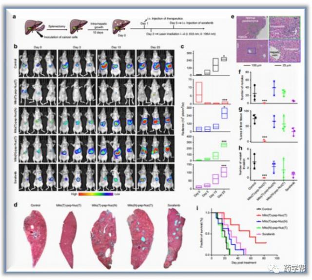 Nat. Comm.：南京大學蔣錫群、胡勇等發現殺死肝轉移癌細胞的方法