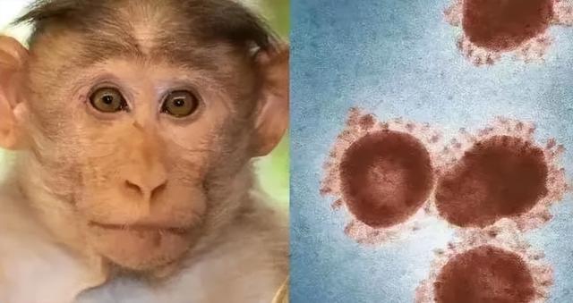 猴痘已擴散到亞洲，爲何還不是“國際關注的突發公共衛生事件”？