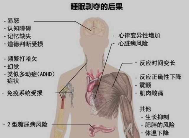 原来新加坡这么多小伙伴和我一样可怜，70%的人缺“睡”